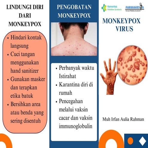 MONKEY POX VIRUS (MPX) ATAU CACAR MONYET | PPTX