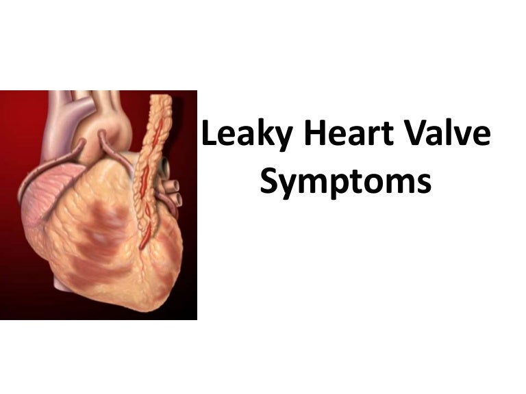 Asian Heart Institute Leaky heart valve symptoms