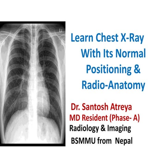 Learn Chest X-Ray With Its Normal Positioning & Radio-Anatomy
