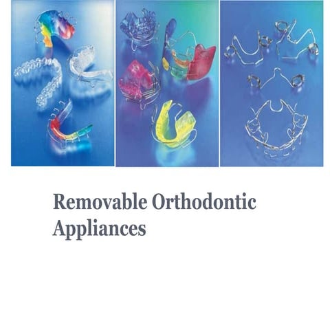removable orthodontic appliances