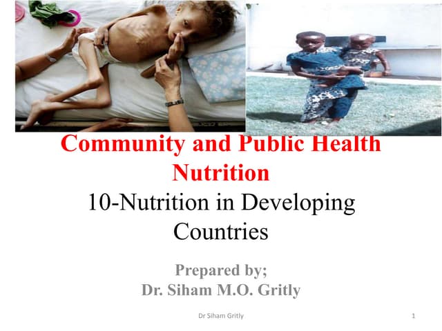 Lec 9 nutrition in developing count...