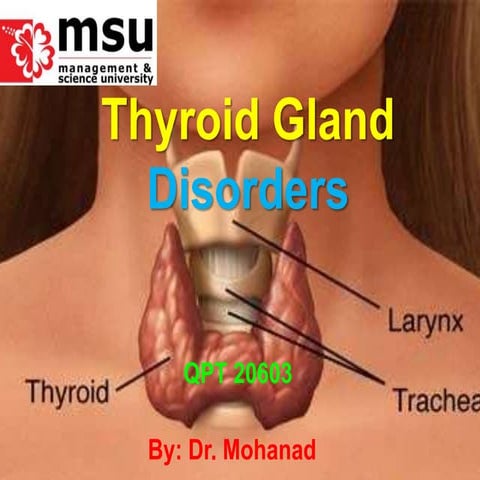 Thyroid disorders