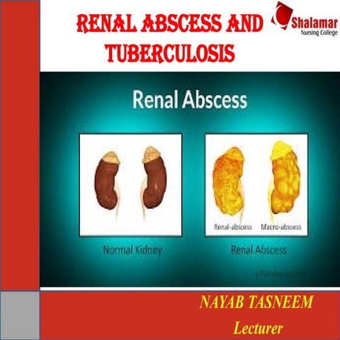 Lect 35. Renal Abscess & Tuburclosis.pptx