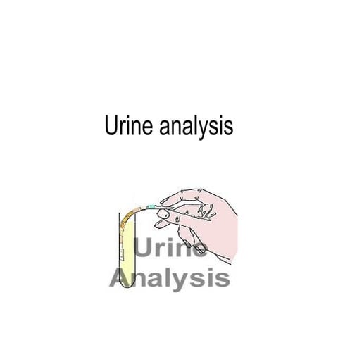 lecture 02. urine examination analysis.ppt