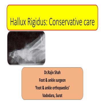 Lecture 45 shah hallux rigidus | PPTX