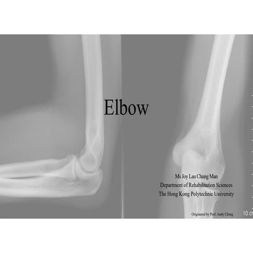 Radius and ulna.pptx