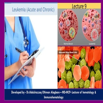 Hodgkin Lymphoma- H.L.pdf