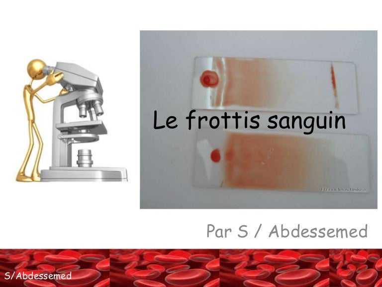 La confection du frottis sanguin.