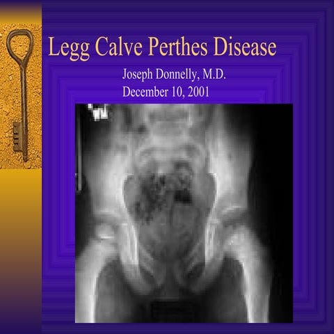 Legg calve perthes disease donnely 2001 5afad2fc5e0b007027c03a29b821eb3c