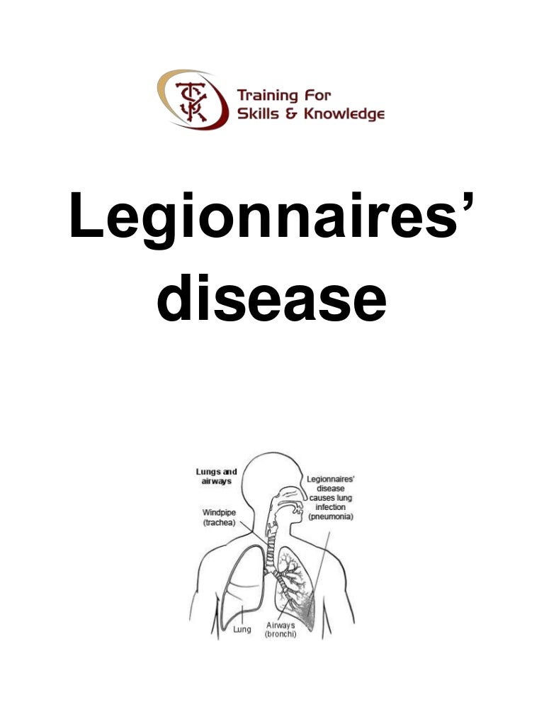 Legionnaires’ disease