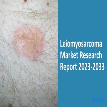 Leiomyosarcoma Market 2023: Epidemiology, Industry Trends, Size, Share And Fo...