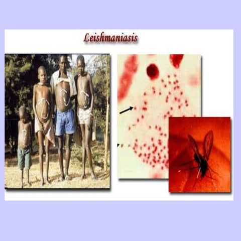 Medical Parasythology _Leishmaniasis.ppt