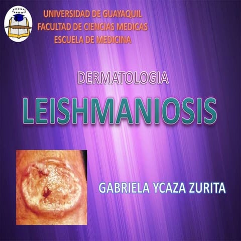 Leishmaniasis