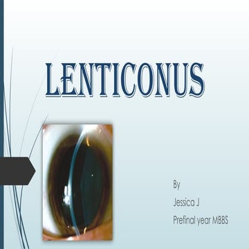 Lenticonus_ophthal 1234567890 by kamal.pptx