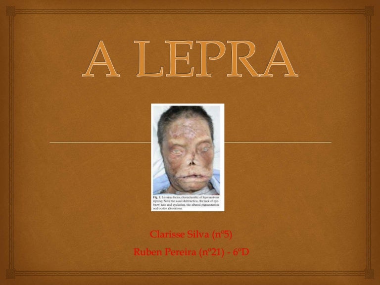 Lepra