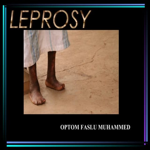 Leprosy