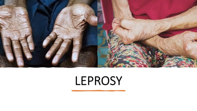 Leprosy microbiology