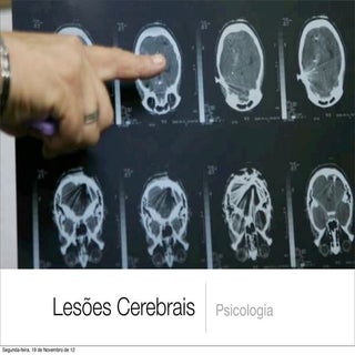 Lesões cerebrais - Psicologia