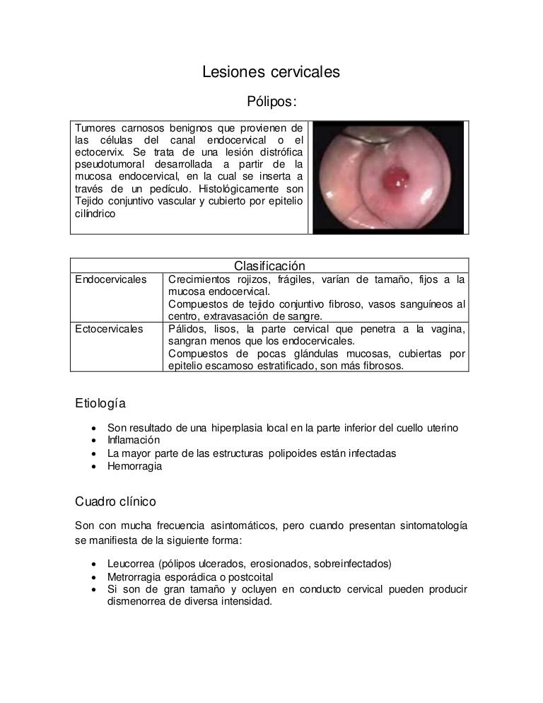 cauterizacion cuello uterino y embarazo cauterizacion cuello uterino y embarazo