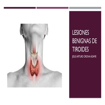 PRESENTACIÓN LESIONES BENIGNAS DE TIROIDES.pptx