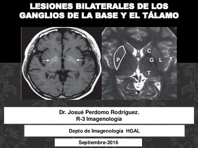 Cómo hacer que la inflamación nasal desaparezca