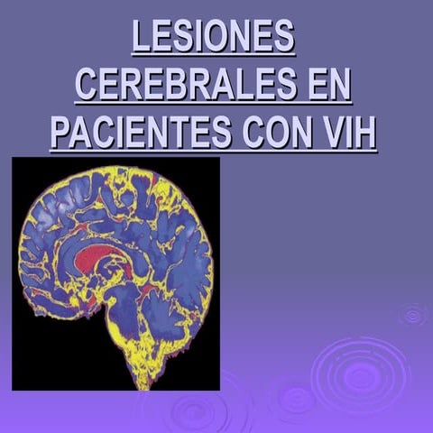 Lesiones Cerebrales En Pacientes Con Vih