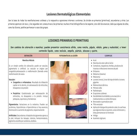 Lesiones dermatológicas elementales.