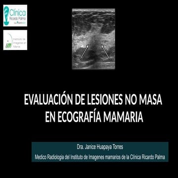 LESIONES NO MASA EN ECOGRAFIA DE MAMA-CRP.pptx