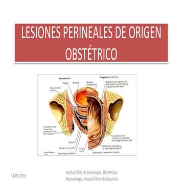 lesiones-perineales-de-origen-obst-trico-pptx