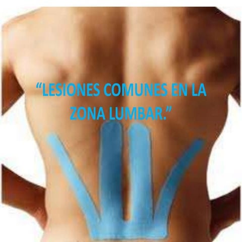 "LESIONES COMUNES EN LA ZONA LUMBAR"