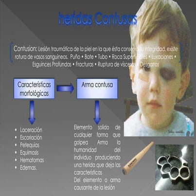 Lesionologia. Sharon Guart.