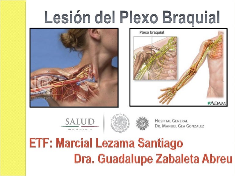 Lesion de Plexo Braquial Lesion de Plexo Braquial