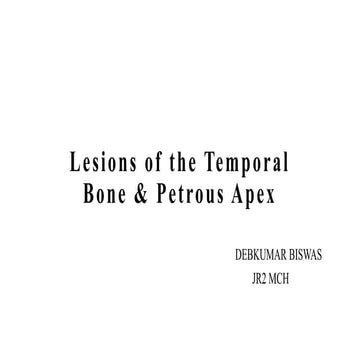Lesions of the  temporal bone & petrous  ppt