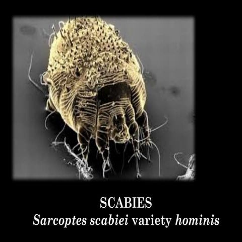 Lesson 8 SCABIES (Skin Diseases Lesson for Nursing Students).pptx