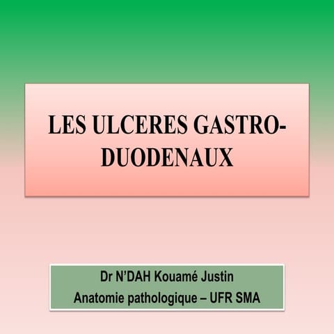 Les ulceres gastro duodenaux. irep pptx