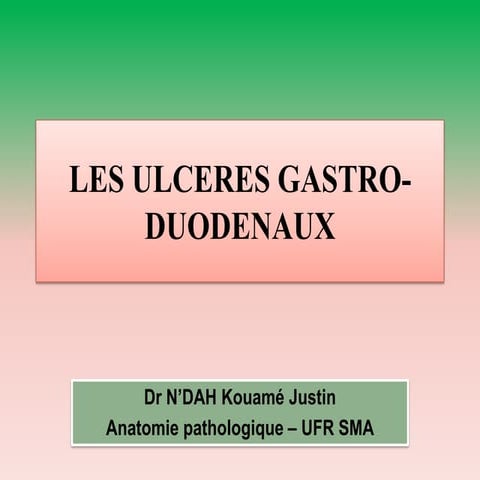 Les ulceres gastro duodenaux. irep pptx (1)