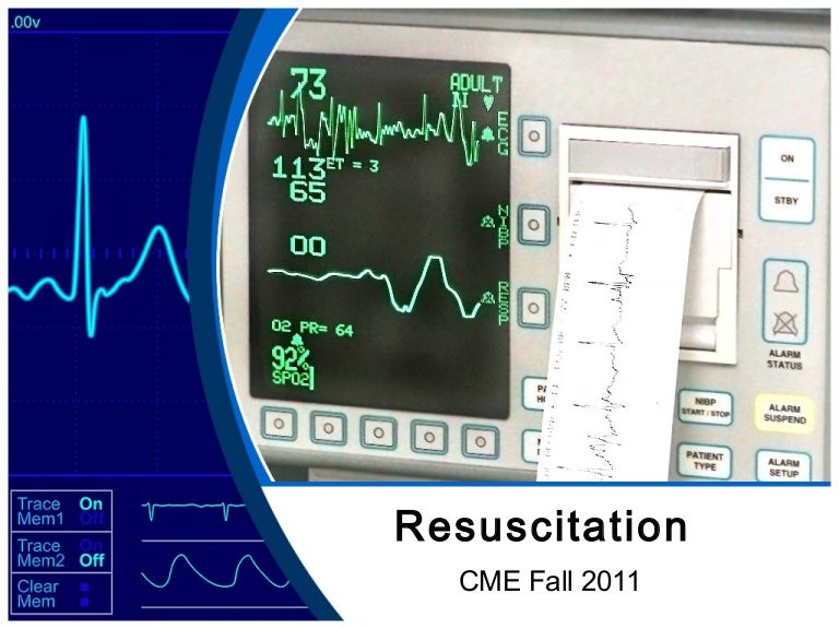 Lethal Cardiac Rhythms Manual Defibrillation