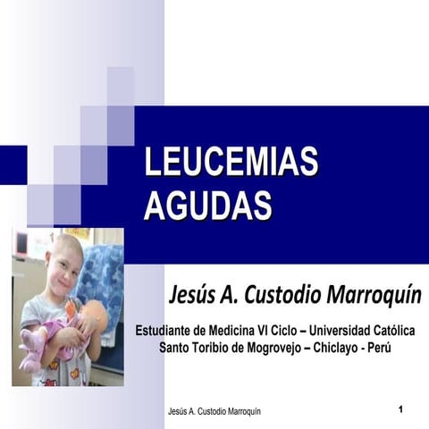 Leucemia Aguda