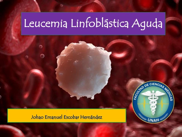 Leucemia Linfoblástica Aguda