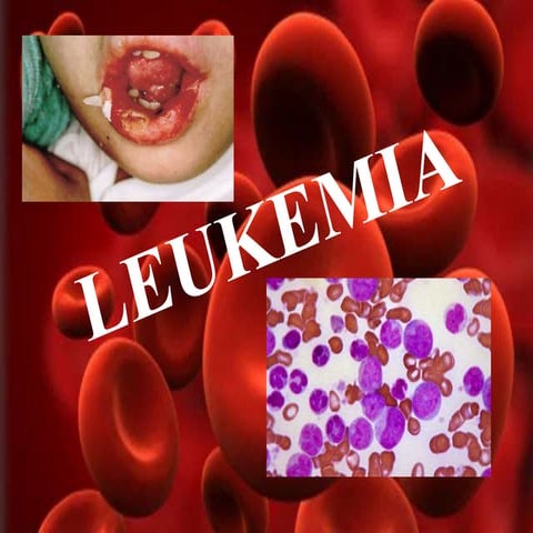 Austin Leukemia