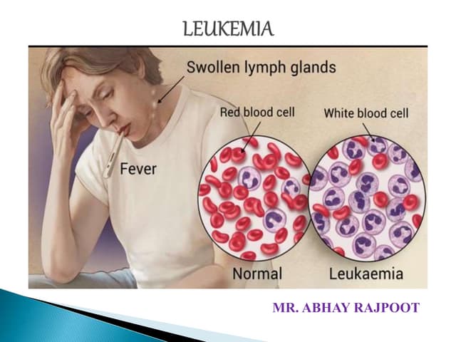Image showcasing Pathophysiology of leukemia | PDF