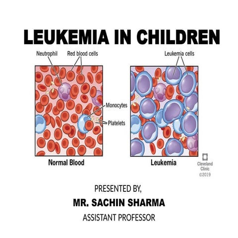 S. Y. G. N. M. CHILD HEALTH NURSING Leukemia in Children.pptx
