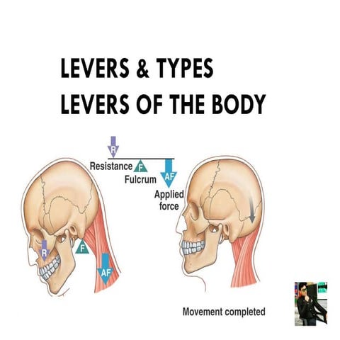Levers in Human Body ( Physiotherapy ) - Dr Rohit Bhaskar