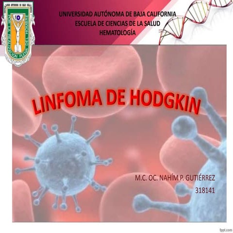 Linfoma de Hodgkin 