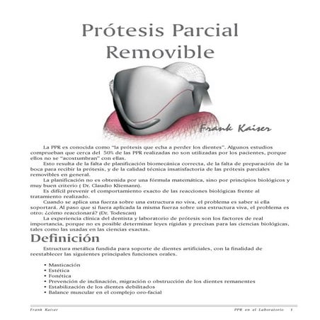  protesis parcial removible