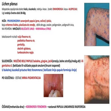 Aktuelle Leitlinien Zur Behandlung Des Lichen Ruber Planus Mucosae – HHDKEB