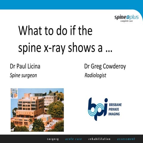 What to do if the spine x-ray shows a ---? – Part 1