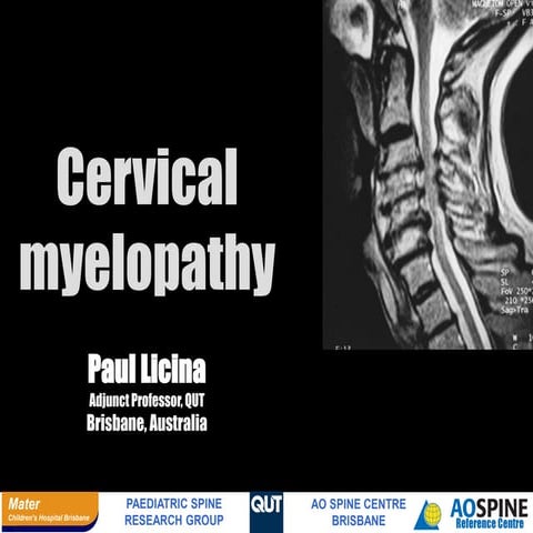 Myelopathy management