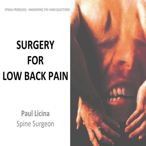 Surgery for low back pain