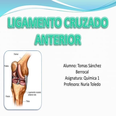 Ligamentos cruzados